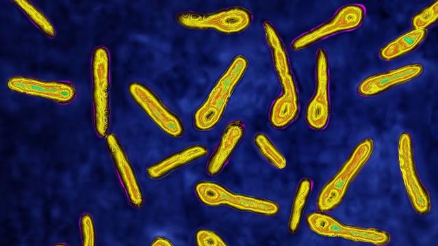 科普向——战“疫”进行时！三分钟看完世界病毒发现史！