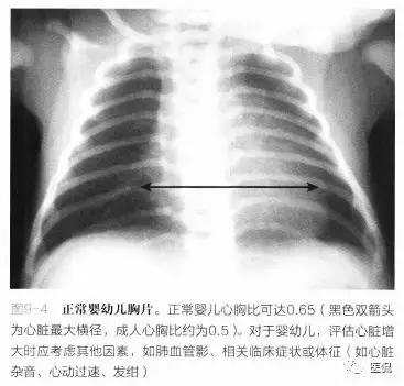胸侧位正位片可以检查出什么,胸部正位侧片是测什么的