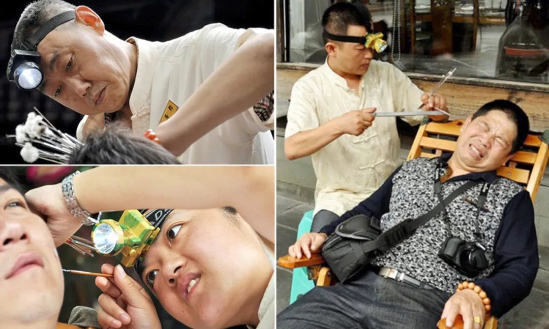 棉签掏耳朵的正确方法,给孩子掏耳朵最佳方法