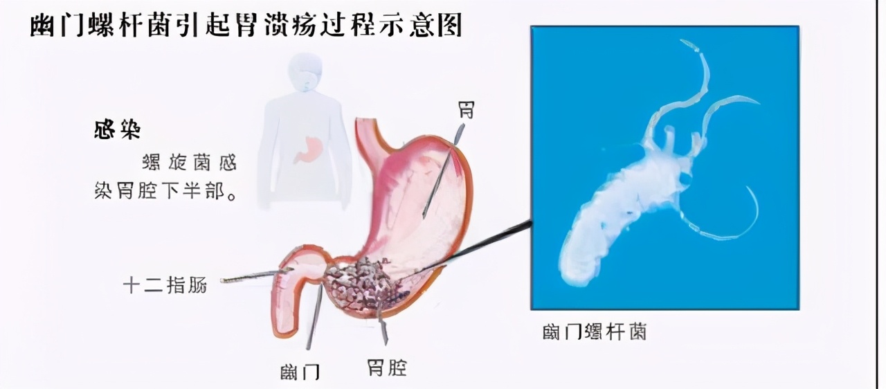 喝细菌汤，涂病人呕吐物，科学家靠“自虐”获得搞笑诺贝尔奖
