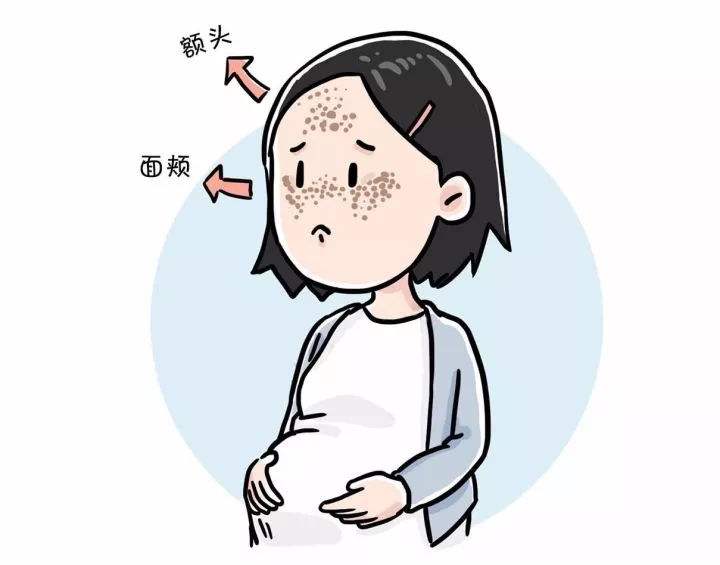 活性斑用什么调理,活性斑和定性斑哪个容易去掉