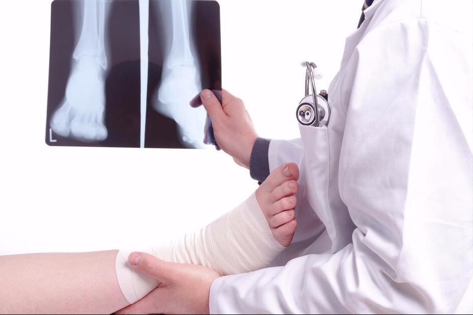 扭伤后24小时内冷敷还是热敷,扭伤是冷敷还是热敷24小时之内