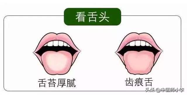 女人湿气重吃什么东西排湿最快,气血不足湿气重的女人该怎么调理