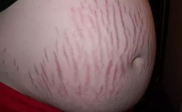 实！在！太！痛！了！生完孩子出产房的那一刻...