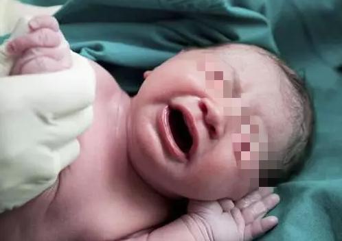 孕妈生下无眼胎儿,孕妇生孩子老公却让她闭嘴