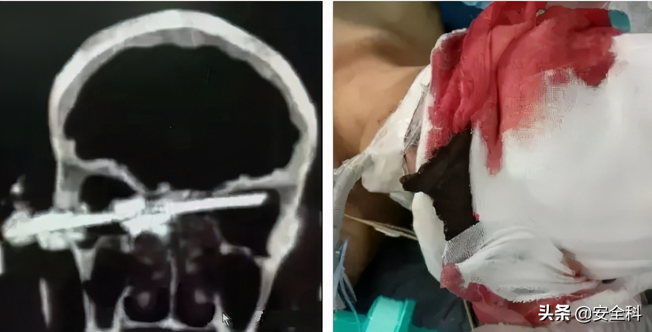 砂轮机未设置防护罩安全隐患描述,砂轮机防护罩安装标准