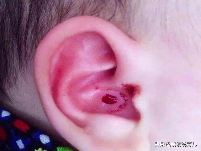 四个月的宝宝睡觉总是摇头挠耳朵,宝宝总是摇头挠耳朵是什么原因