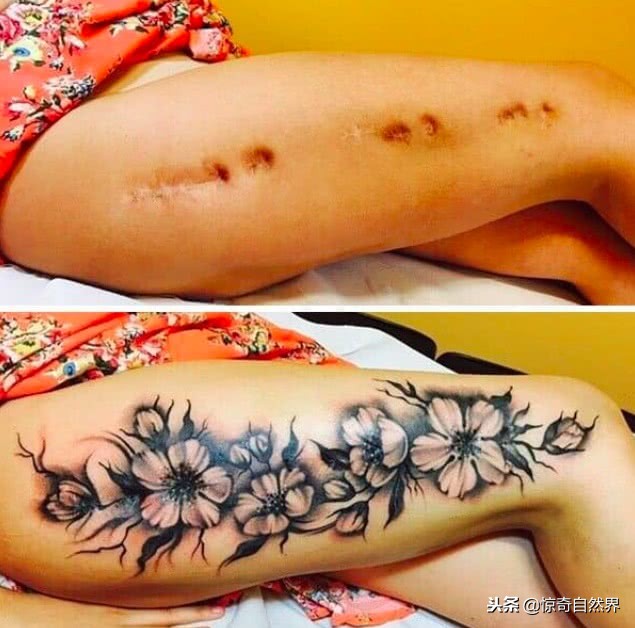 能遮盖疤痕的纹身,遮疤痕的纹身设计