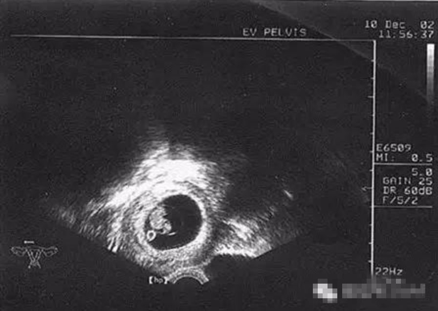 二十七年的坚持终于迎来转机,七年的努力和辛苦