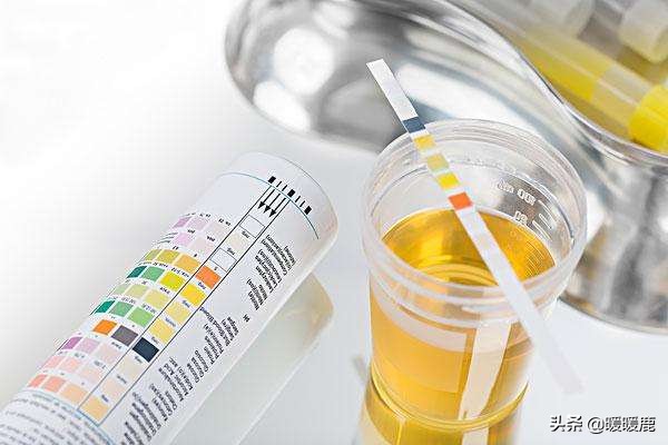 孕妇尿酮体和尿糖同时出现,怀孕尿蛋白尿糖高是怎么回事