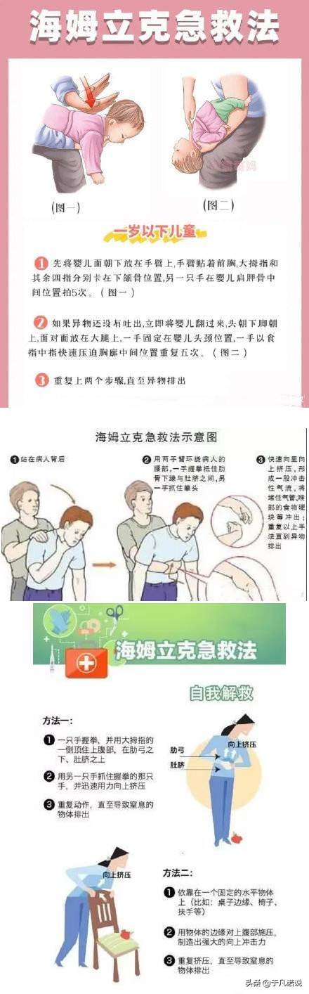 孩子被呛怎么急救,孩子被噎海姆立克