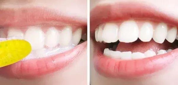 刷牙黄牙变成白牙怎么办,怎么刷牙才会让黄牙变成白牙