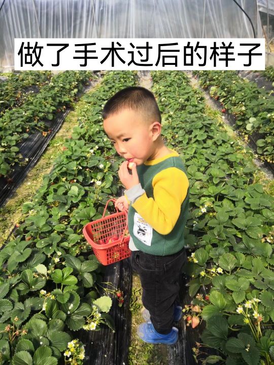 小耳畸形再造手术有后遗症吗,儿童小耳畸形去哪里做手术好