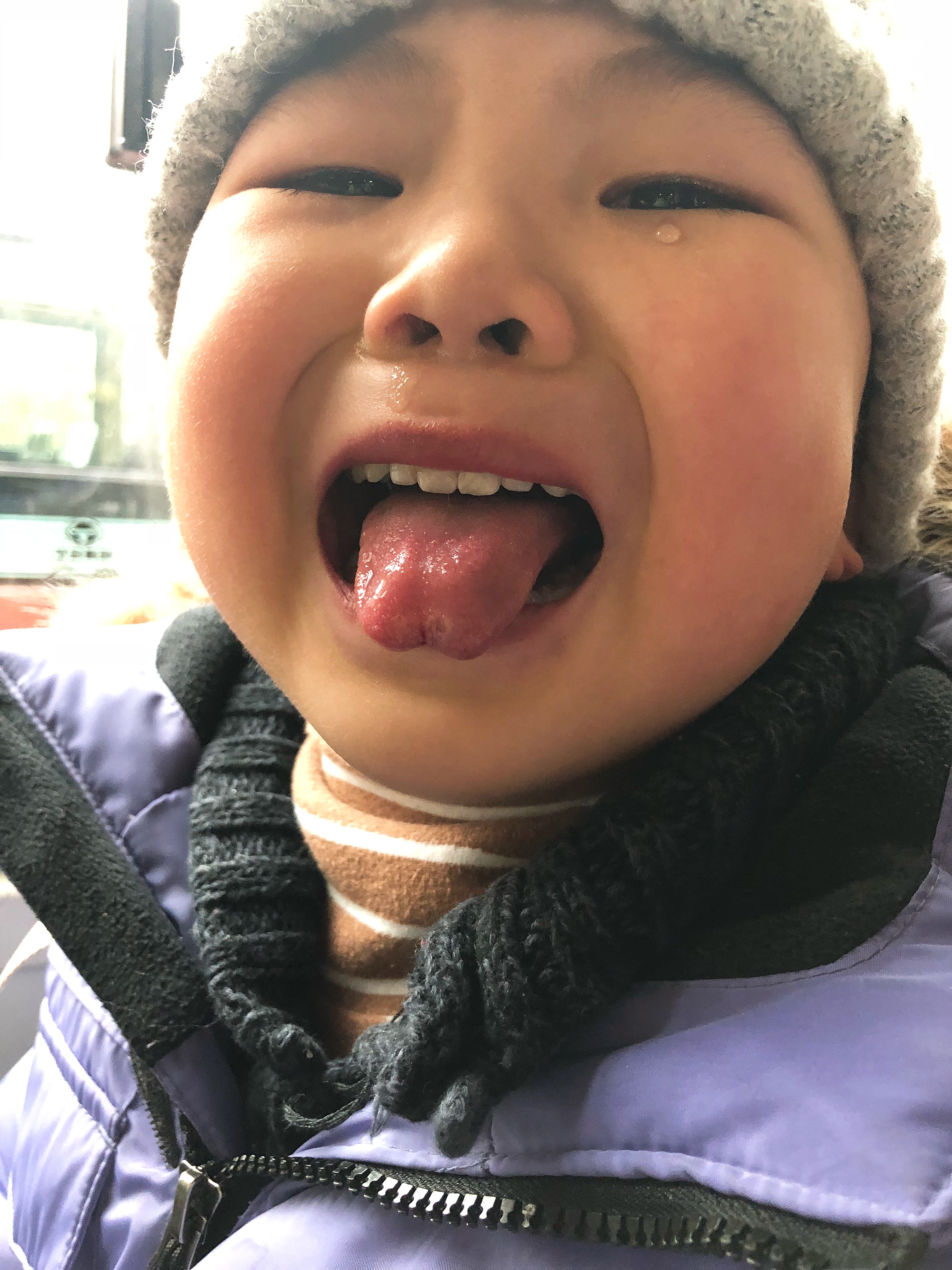 小儿白塞氏病的病因和症状,肉丸子得了什么病