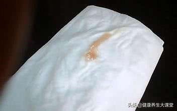 妇科病最怕这三种食物,女性内裤有三大禁忌