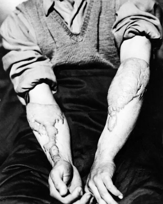 对x线辐射不敏感,x射线的发现和研究历史是怎样的