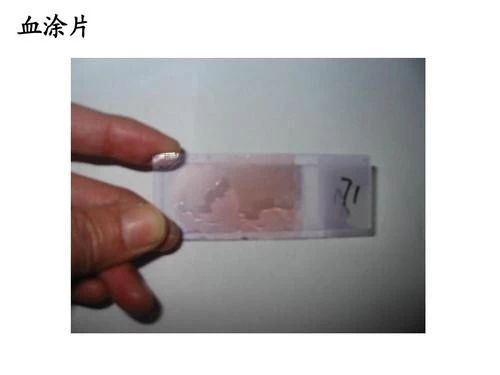 辟谣：猫咪白细胞升高就要使用消炎药？不，谨防滥用抗生素