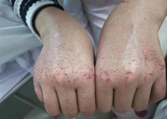 洁芙柔免洗使用方法,洁芙柔75%酒精免洗凝胶