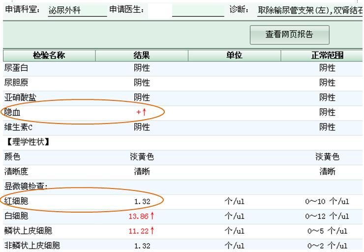 我检查尿有隐血肾没事怎么回事,我的尿检报告结果正常吗