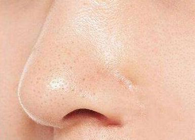 俏肌去黑头怎么样,俏肌护肤品怎么样