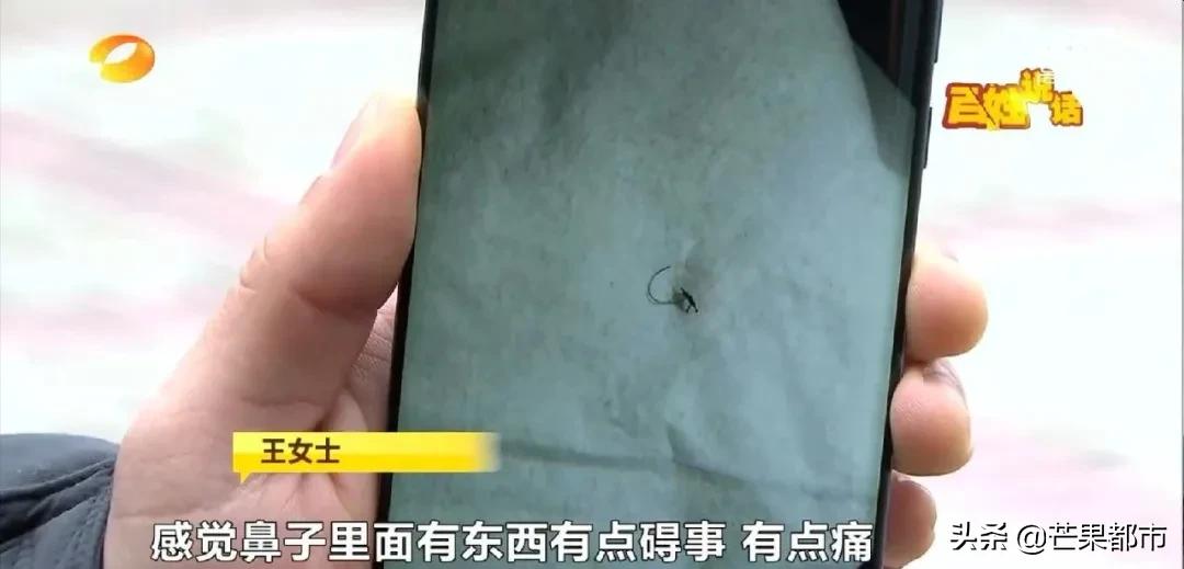 女子隆鼻后发炎流脓不止,女子花两万元变美鼻子却发炎化脓