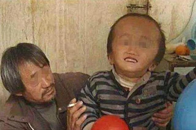 三聚氰胺害了多少人,三聚氰胺害死了多少人