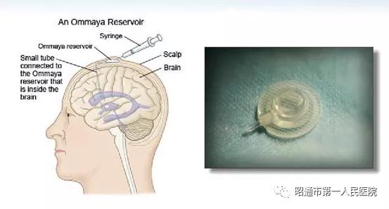 昭通第一人民医院早产儿科,昭通市第一人民医院儿外科