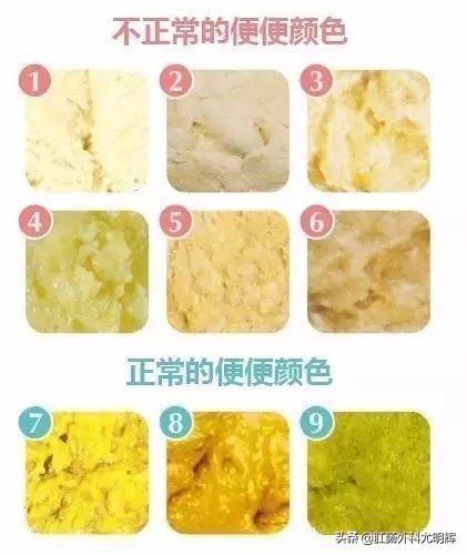 便便中带血是什么原因,便便中带奶瓣是消化不良吗