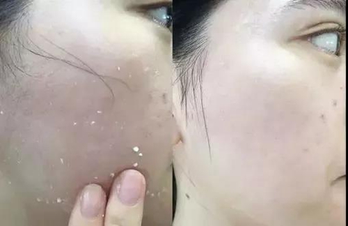 上粉底脸上搓泥是怎么回事啊,一上妆就搓泥怎么办