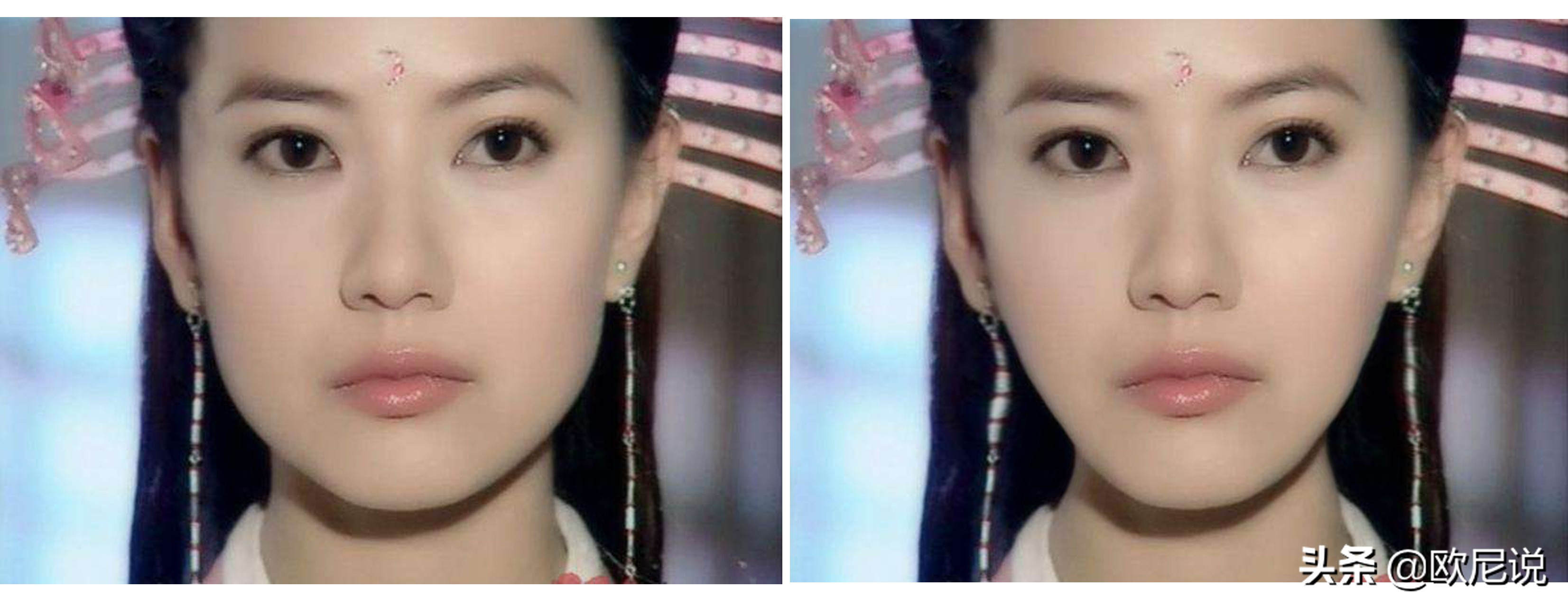 方脸丑怎么办,方脸五官又不好看怎么办