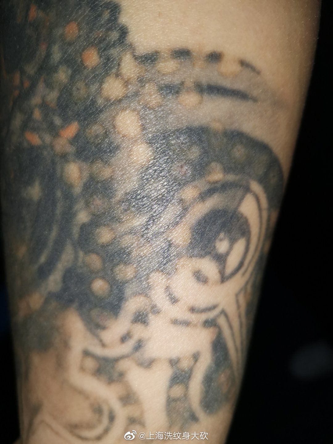 现在最好的洗纹身方法,洗纹身可以用牙膏洗纹身吗