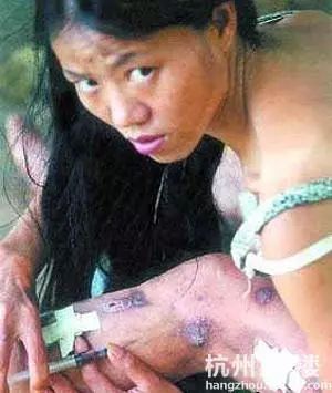 冠军涉嫌贩毒被捕,总冠军吸毒被捕