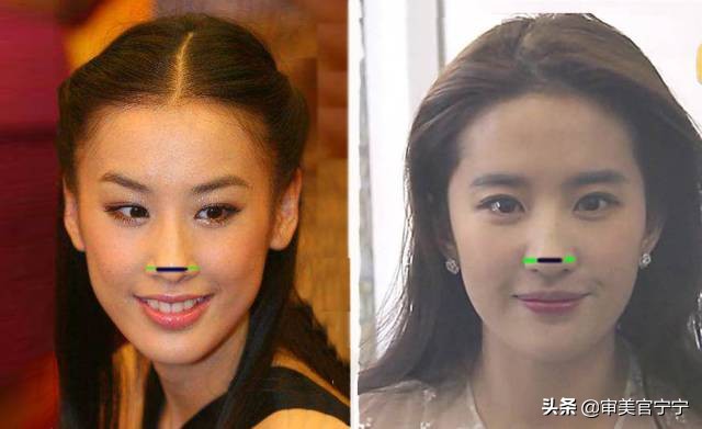 鼻子宽大眼距过近,鼻子宽度大于眼间距原因