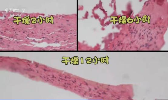 头上秃了一块还能长回来吗,二十三岁头秃还能长回来吗