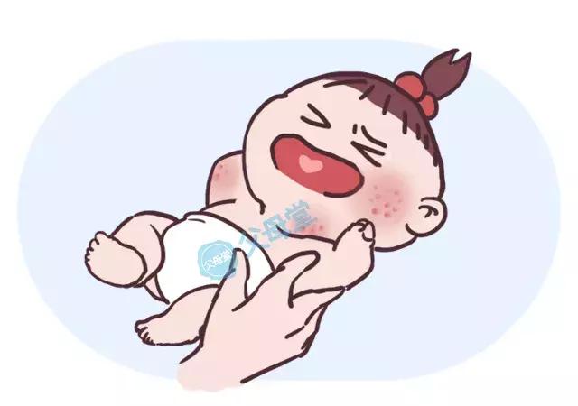 宝宝湿疹老反复教你6招轻松搞定,宝宝出现湿疹正确处理方法