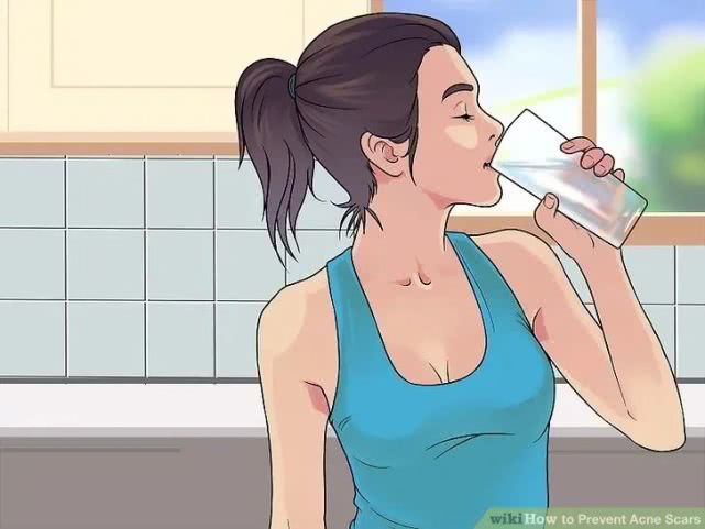 长完痘的红色痘坑怎么弄,怎么预防痘坑形成