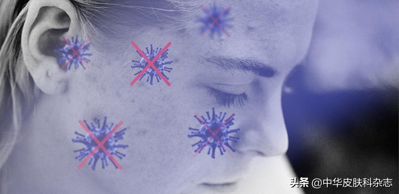 战痘全攻略,战痘全攻略详解