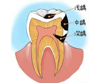 真相大白大揭秘,真相大白的真实案例