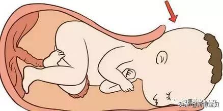 宝宝娩出阶段是宝宝全部出来了吗,新生儿娩出前医生在做什么