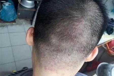 床单久睡不晒螨虫“成堆”？教你1招，不用洗不用晒，轻松除螨虫