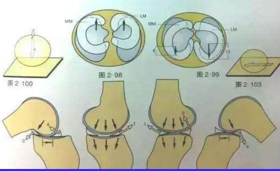 半月板损伤康复训练,半月板损伤膝盖疼的最好治疗方法