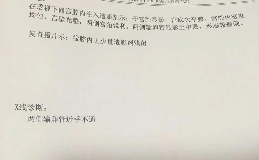 当取卵针戳进我的卵巢时,丈夫在看片取精|成为母亲