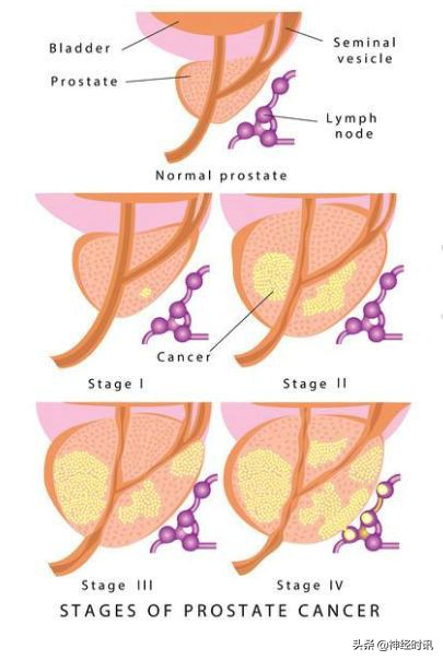 肾脏输尿管膀胱前列腺结构,肾输尿管膀胱解剖示意图