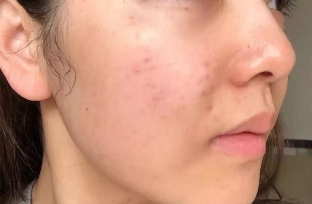 沈梦辰素颜公开惊呆了众多网友,沈梦辰颜值巅峰有多美