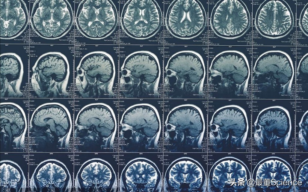 世界最强的医用核磁共振仪,快速磁共振成像mri技术问世