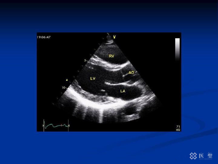 对肺癌晚期的最新治疗,正确认识和应对肺癌
