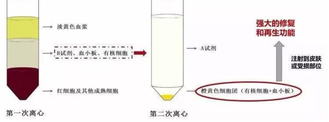 注射玻尿酸和肉毒素除皱皮肤紫红,肉毒素除皱后可以做玻尿酸填充吗