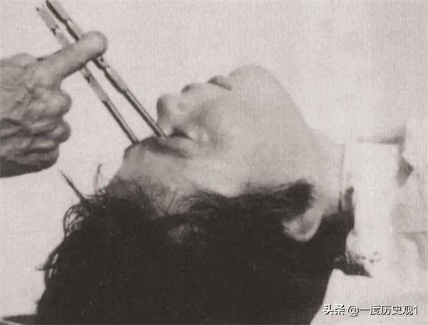 诺奖最多的医学奖,医学史上的诺奖