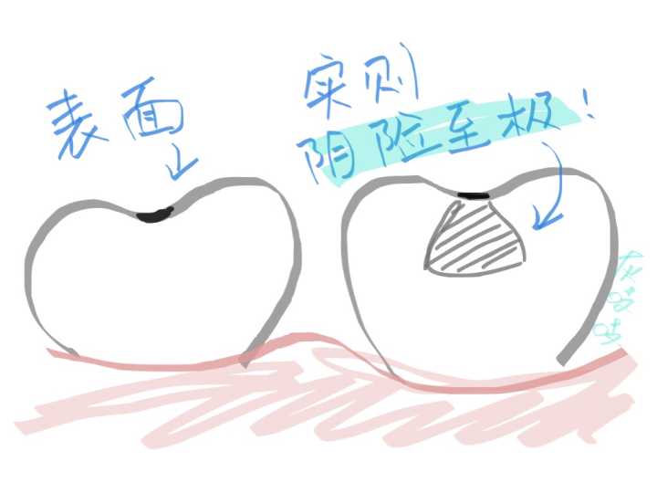 同一个医生做的牙，为什么效果相差那么大