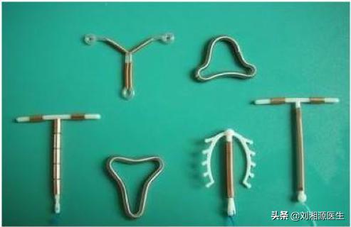 宫腔粘连合并妊娠,宫腔粘连容易导致生化妊娠吗